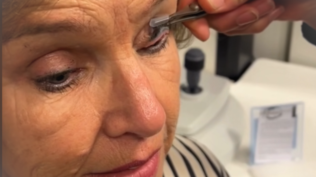The Practical Challenge: Making Upper Lid Imaging Routine