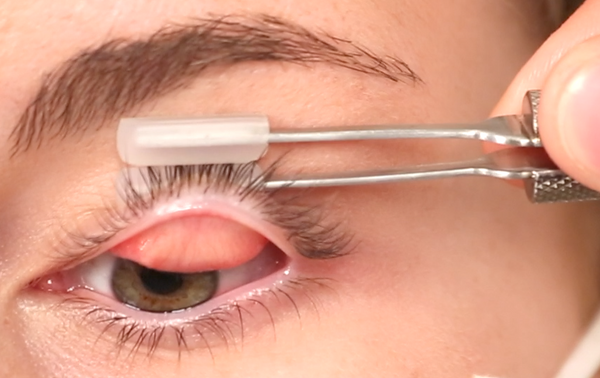 Single-handed tool for upper eyelid eversion and lower eyelid eversion to simplify taking images with a meibographer